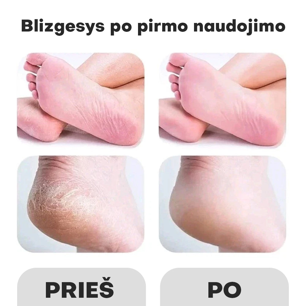 Elektrinis kulnų šveitiklis - Femora